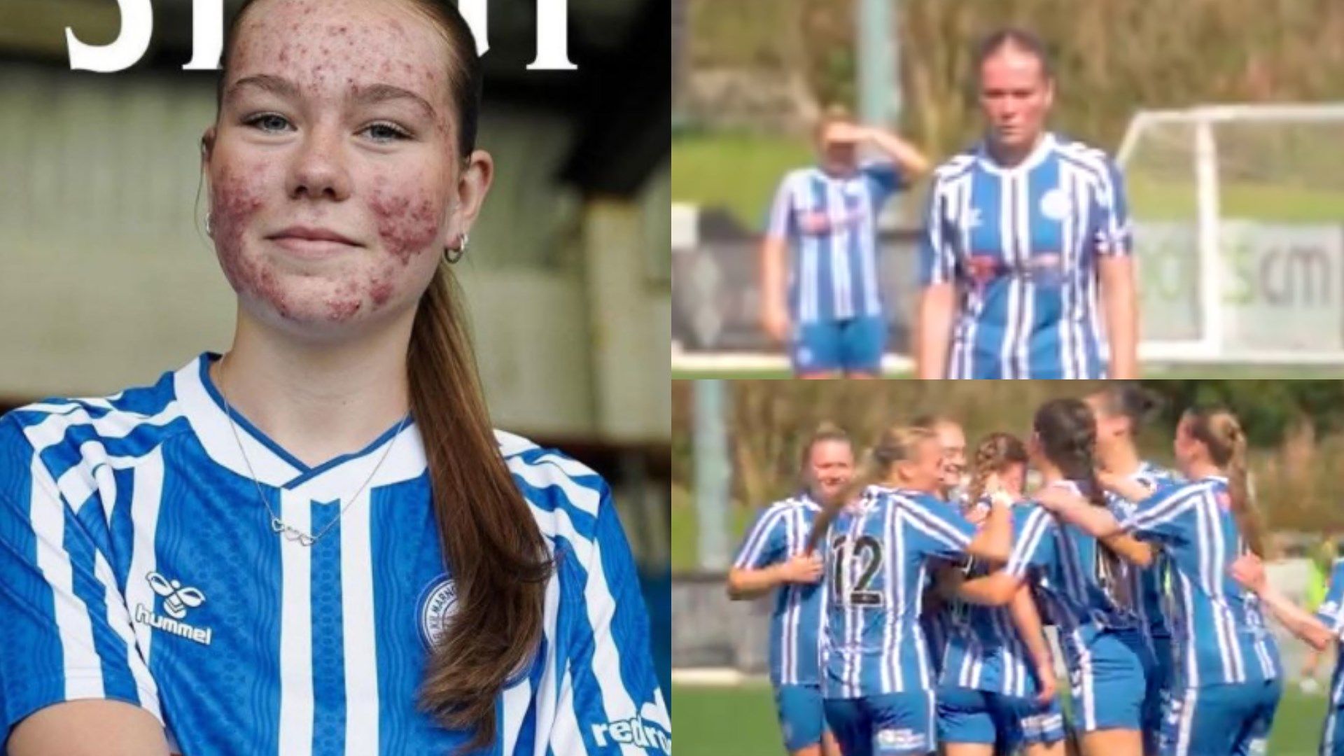 VIDEO: That's how to shut up the haters! Kilmarnock youngster Skye Stout scores stunning free-kick goal on debut after horrific online abuse over facial acne