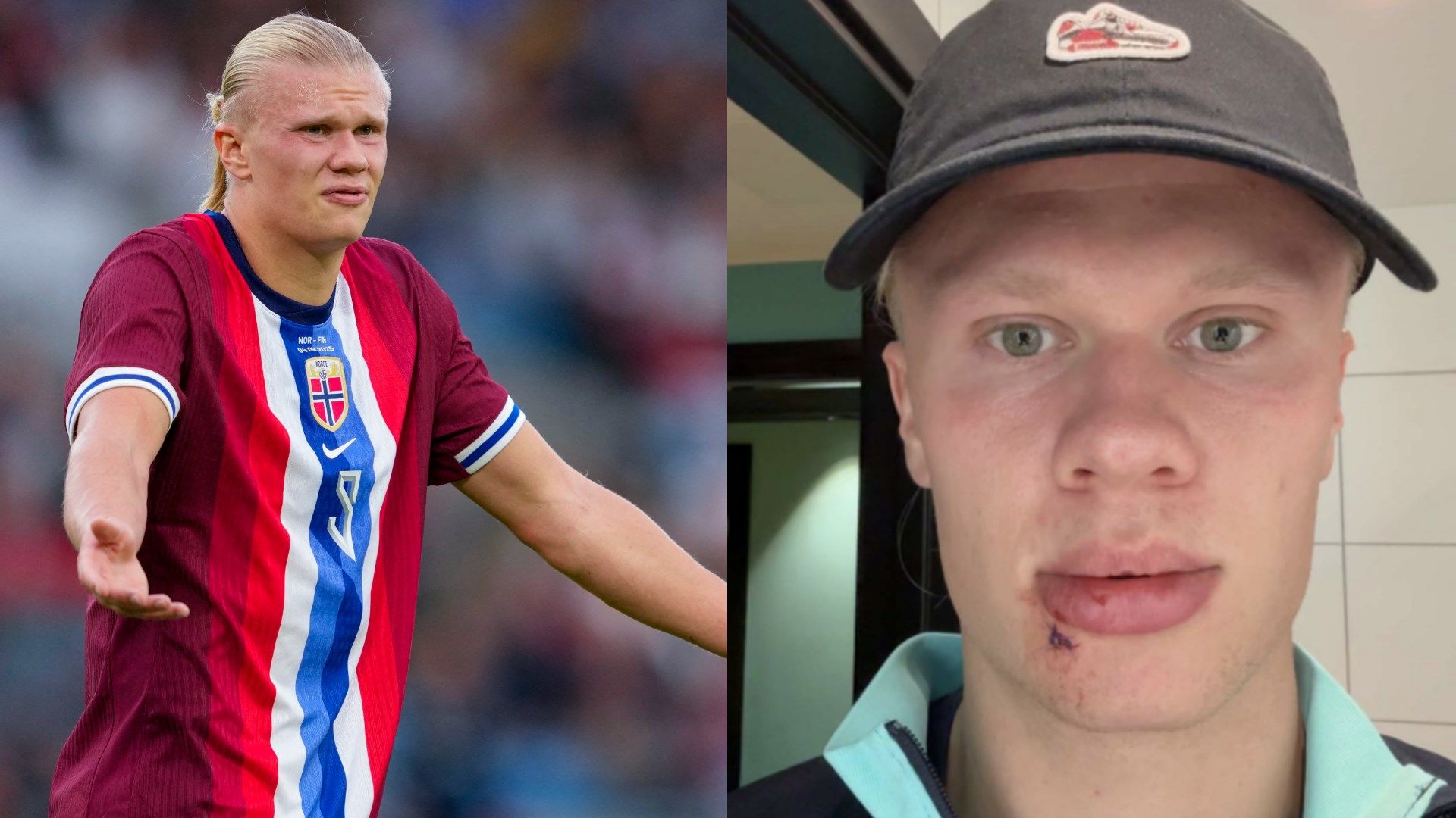 'Never seen anything like it' - Martin Odegaard lifts lid on Erling Haaland's freak injury
